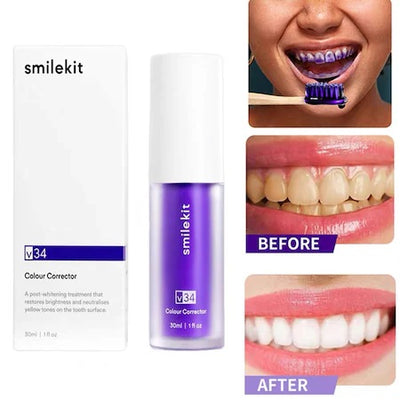 Set 2 x Spuma Eficienta V34 SmileKit Pentru Albirea Dintilor 30ml